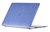Накладка MacBook 15 Air (A2941) 2023 / 15 Air (A3114) 2024 / 15 Air (A3241) 2025/ 15 Air (A3448) 2026 Glitter Sky/Синя з блискітками 1641-80 фото